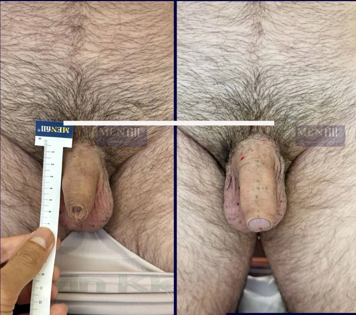 Caso 04 — registro fotográfico antes e depois, uso ilustrativo
